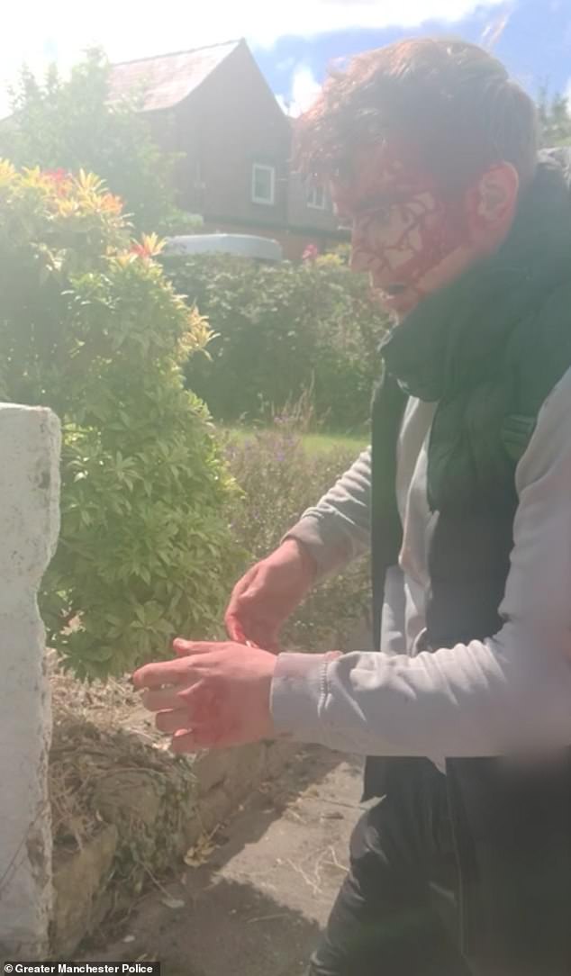 Monks is seen with blood pouring down his face, pleading innocence as he insisted: 'I wasn't driving, it wasn't me. I've hit my head. I've hurt my head and my jaw'