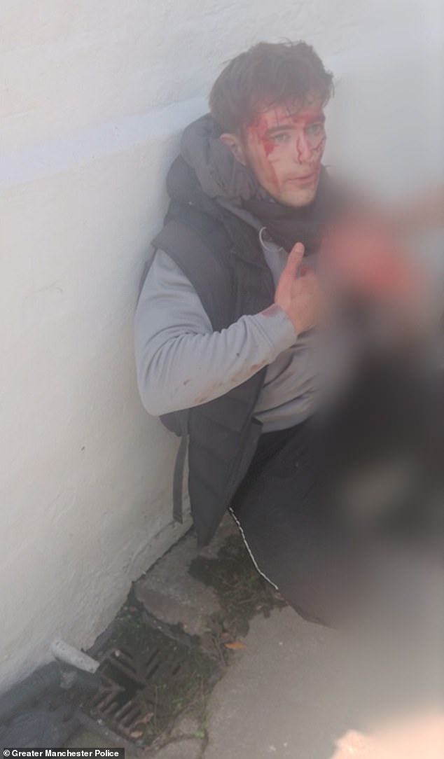 Monks, who had a provisional licence and no insurance, has now been sentenced for causing serious injury by dangerous driving
