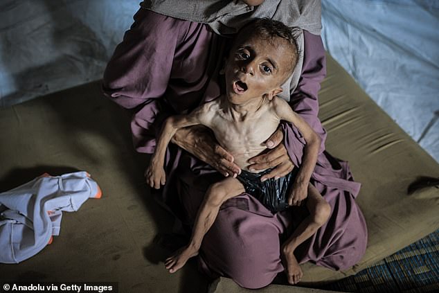Young Muhammad is said to have dropped from nine kilograms to just six. Healthy children his age typically weigh nearly double