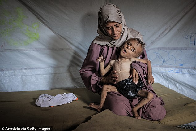 One quarter of all children in Gaza are now suffering from malnutrition, MSF warns