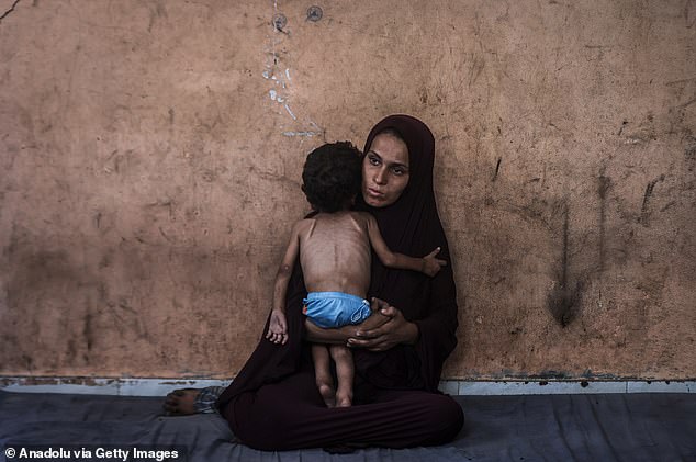 Two year old Yezen Abu Ful, whose health has deteriorated due to lack of access to food and nutritional supplements, is seen with his mother in the Al-Shati Refugee Camp in Gaza Strip on July 24, 2025