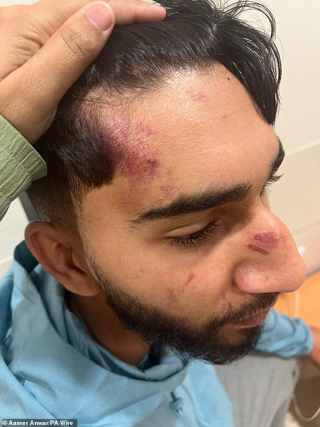 The head injury received by Amaaz is seen in this photo, provided by his solicitor
