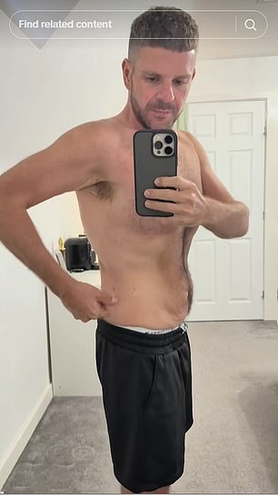 He said that he is commonly asked questions about his loose skin