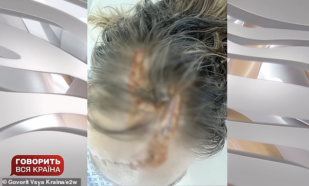 A hospital photo shows deep wounds to Maria's scalp, running from the crown of her head down to her right temple