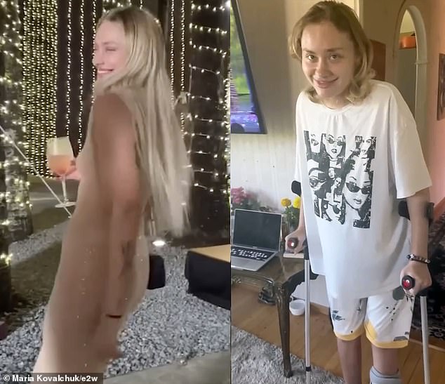 Maria pictured before and after the attack in Dubai