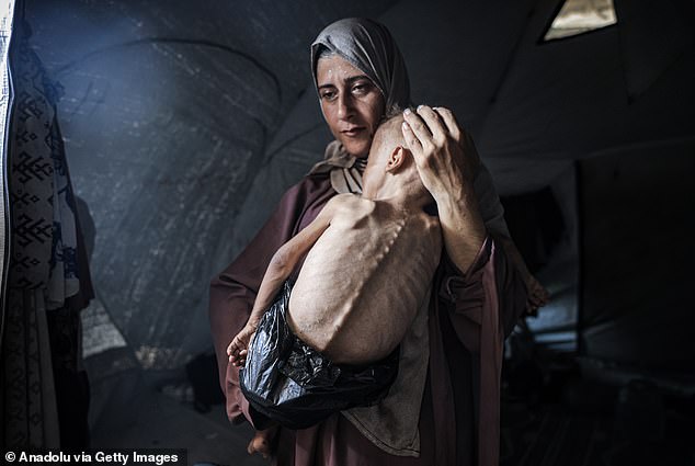 Journalist Ahmed al-Arini shared horrifying pictures of severely malnourished Muhammad Zakariya Ayyoub al-Matouq in his mother's arms in the spartan tent they now share in Gaza City to highlight the situation