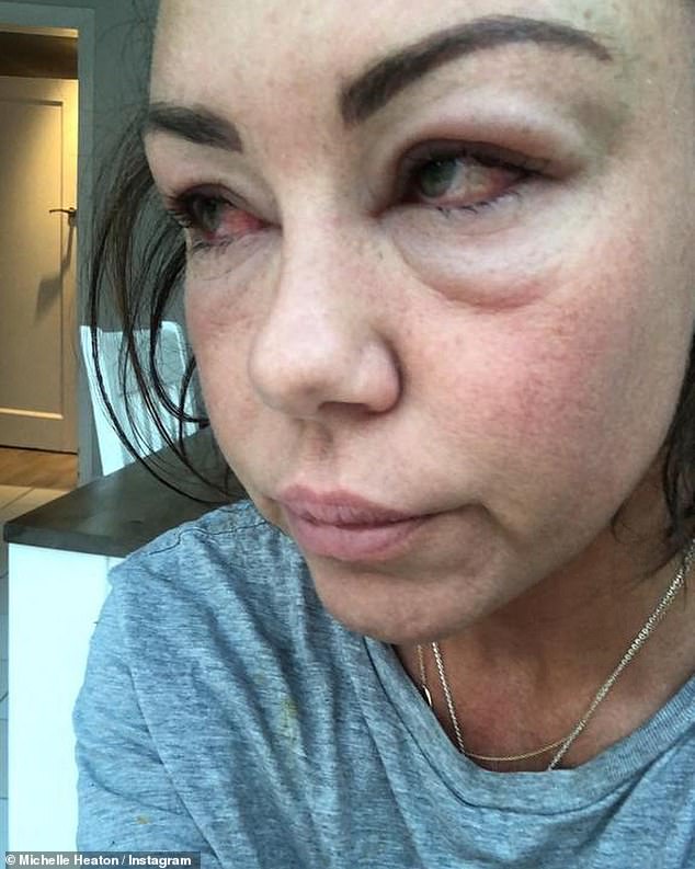 At the height of her battle, the singer drank two bottles of wine and a bottle of vodka 'virtually every day since 2018', when an intervention led by Katie Price resulted in her checking herself into rehab