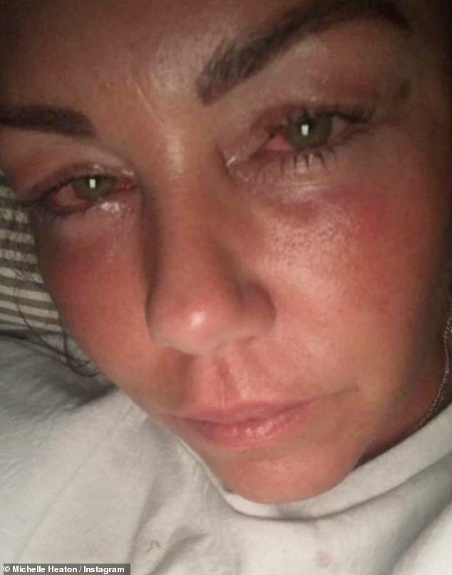 The mother-of-two has been sober for four years after being hospitalised in 2021 during her battle with drink and drugs (pictured during her battle)