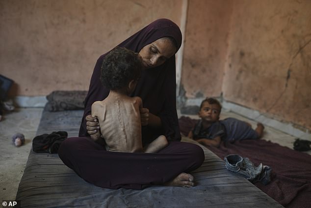 Naima Abu Ful holds her malnourished 2-year-old child, Yazan, at their home in the Shati refugee camp in Gaza City on Wednesday, July 23, 2025