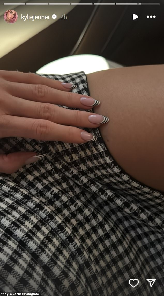 Kylie shared a closeup photo of her nails with her 393 million followers