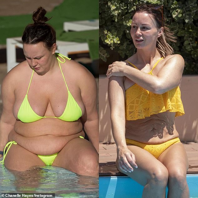 After two breast surgeries, multiple rounds of liposuction, and several procedures to tighten her loose skin, Chanelle vows she is finally done with going under the knife