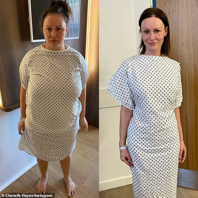 Chanelle, who has shared the stages of her weight-loss journey on Instagram, credits the gastric sleeve surgery for her newfound confidence but admits there are still areas of her body which make her feel insecure