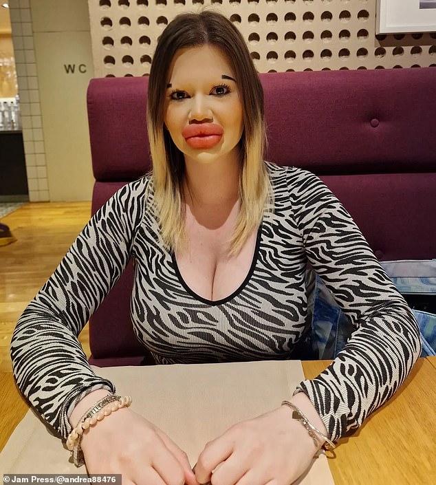 The social media influencer has previously admitted she struggles to find love because of her dramatic look (pictured after)