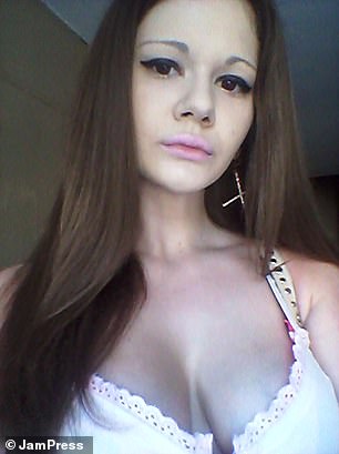 Andrea before surgery and filler