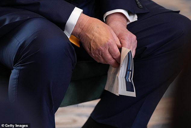 The makeup covering those bruises has been visible in multiple press photos throughout Trump's trip