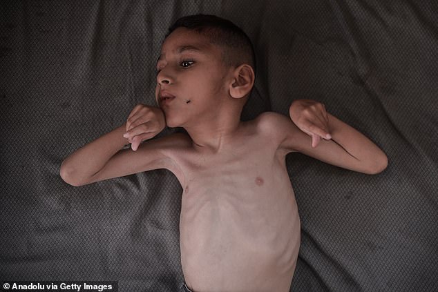 President Trump pledged action to ¿get the children fed¿ in Gaza, saying: ¿That¿s real starvation stuff... you can¿t fake that¿