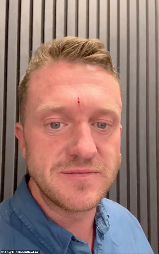 In another video, posted at 5.09pm on Monday - hours before the scuffle - Robinson had a cut on his forehead. He said he had a 'fight with a door'
