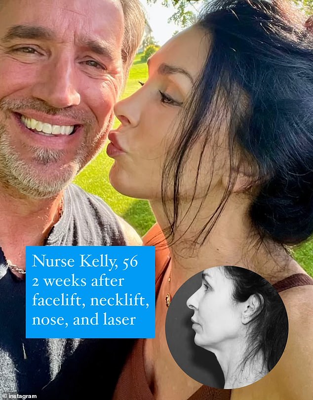 The procedures included a deep plane facelift, brow lift, neck lift, rhinoplasty, fat transfer, and laser resurfacing. Pictured: Main (after surgery) and inset (before)