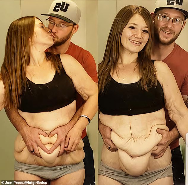 Lexi Reed with her husband Danny Reed embracing her loose skin after her weight loss journey