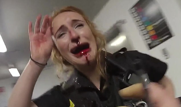 PC Ward had her nose broken by Amaaz, who also attacked another female officer and a tourist