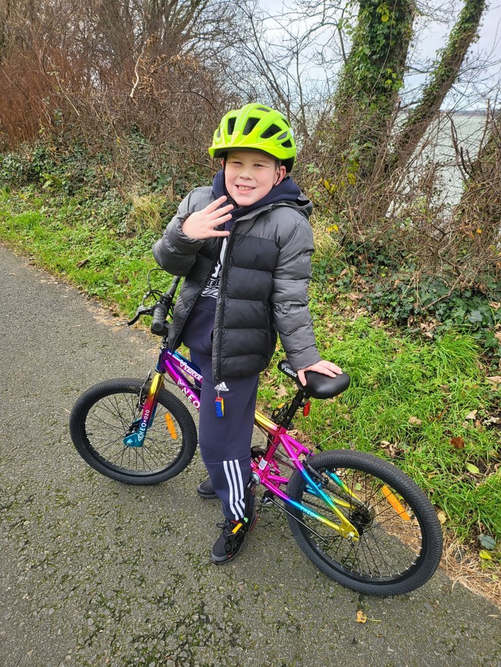 Eight-year-old Caio Shaw with his thumb bitten off by a dog, standing next to his bike.