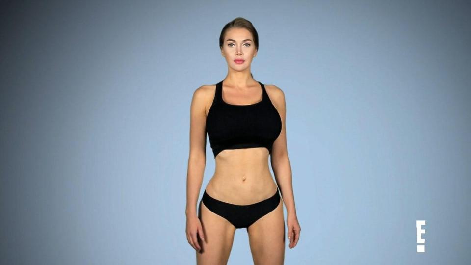 Pixie on the E! show, Botched, where she was refused a hairline reduction and told she has body dysmorphia