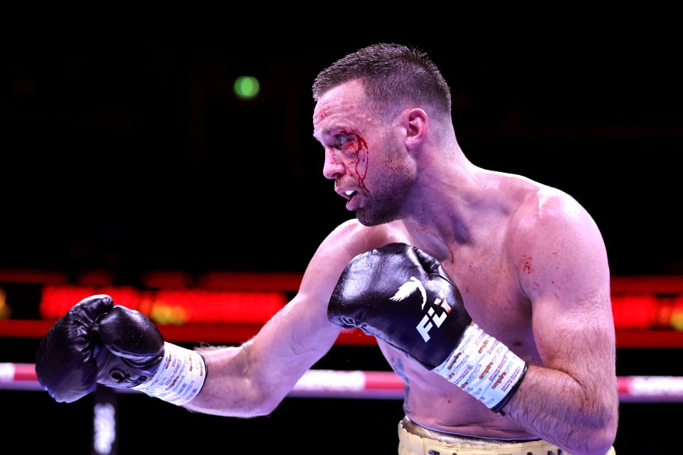 Boxer Josh Taylor with a cut above his eye.