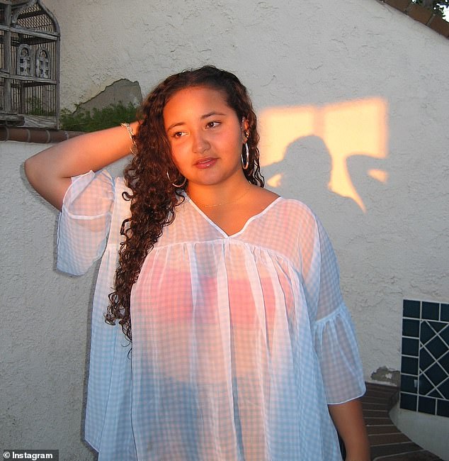 Viana Poggi, 18, was making s'mores with her cousin on a tabletop fire pit on July 6 when flames suddenly erupted