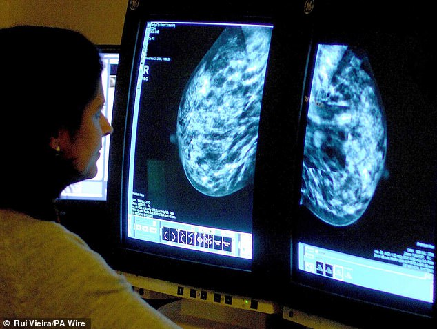 A third of women still do not regularly check their breasts (file photo)