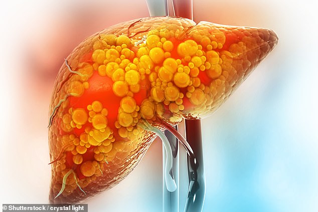 The 36-year-old shared which foods she's cutting out from her diet to reverse her NAFLD