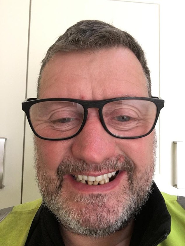 Grant Lakey spent decades struggling with his teeth after a scaffolding accident in 1995