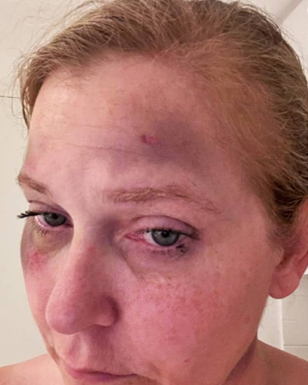 Four photographs published by The Times are said to show Ms Giuffre after an incident near Dunsborough on January 9 after which she was treated in Royal Perth Hospital.