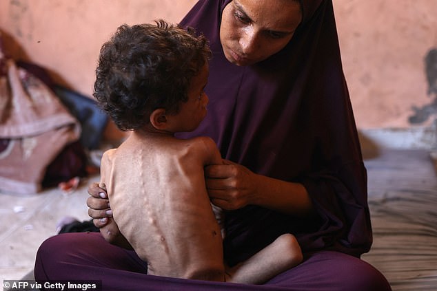The United Nations has estimated nearly 100,000 women and children in Gaza are approaching malnutrition