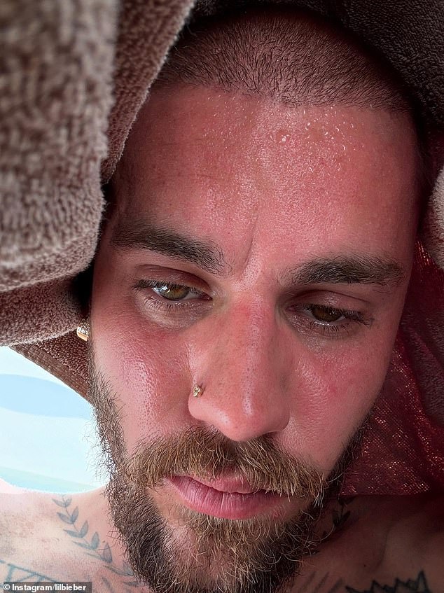 Justin Bieber sparked fan concern once again with another cryptic Instagram post