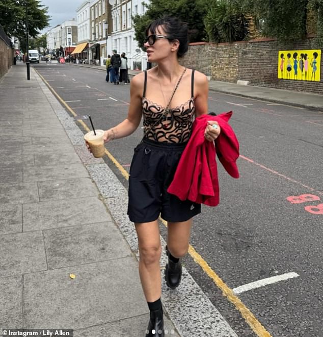 Taking to Instagram on Sunday, the singer showed off the results of her recent procedure in the daring top with a black lace print and a matching mini skirt