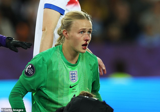Hannah Hampton, who suffered a bloody nose, was England's hero against Sweden