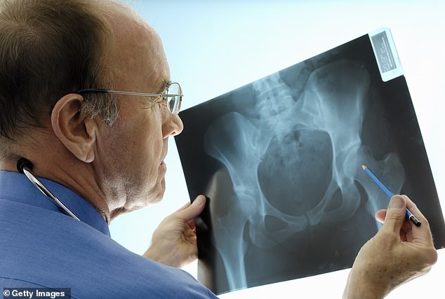 More than 100 leading NHS doctors have warned Health Secretary Wes Streeting that failing to honour his pre-Election commitment to urgently rollout screening clinics for osteoporosis risks causing thousands of preventable deaths (stock image)