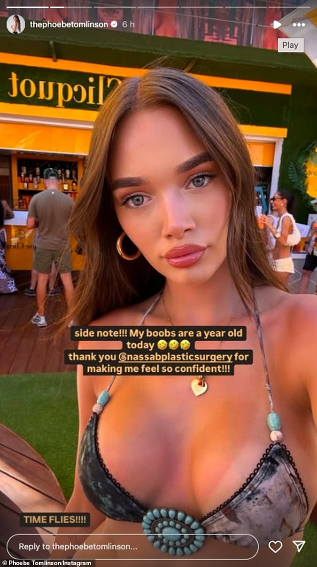 Phoebe Tomlinson posed in a skimpy bikini as she marked one year since having her boob job on Tuesday