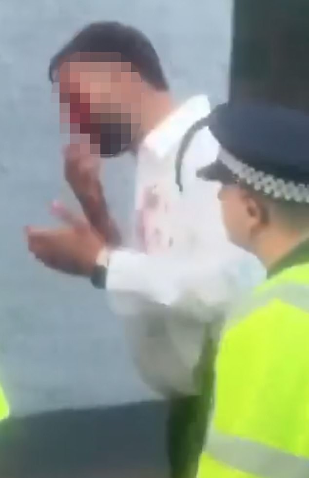 One man was seen with a nasty cut on his head and blood on his top as he walked past police
