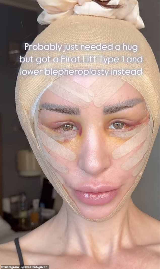 90 Day Fiancé star Shekinah Garner (pictured) underwent a Firat facelift, and showed the aftermath of the surgery to her followers