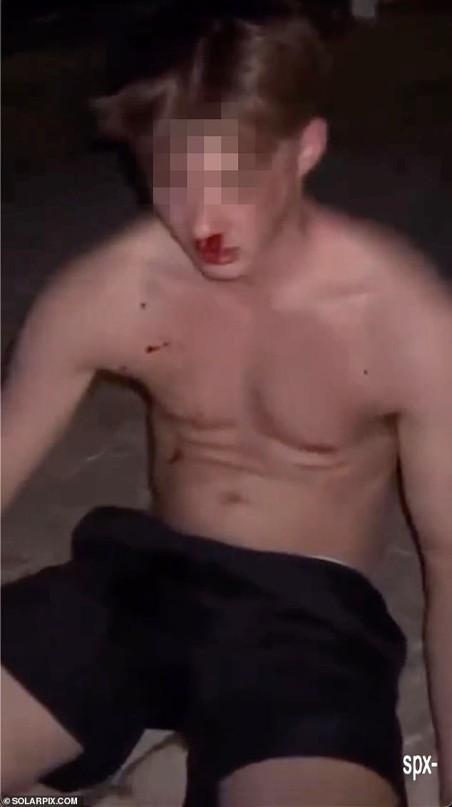 The brutal attack took place in the early hours of July 17 and quickly spread across social media