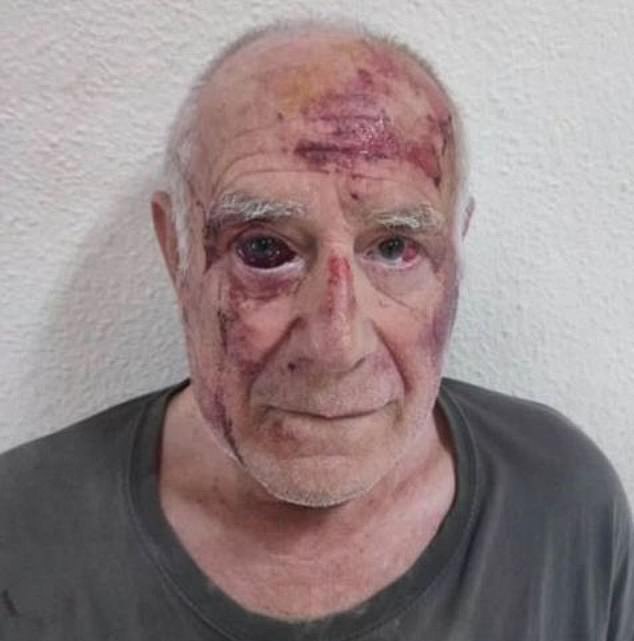 The man, named locally as Domingo, said the men jumped on him and hit him before he was discovered covered in blood last Wednesday