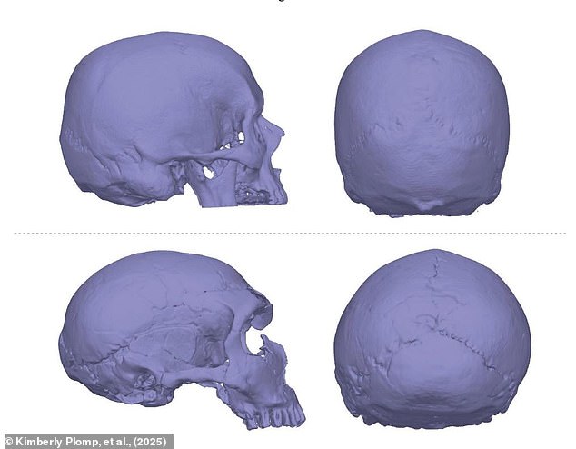 Scientists compared the skulls of Homo sapiens (top) with and without Chiari malformations to the skulls of ancient hominins, including Neanderthals (bottom)