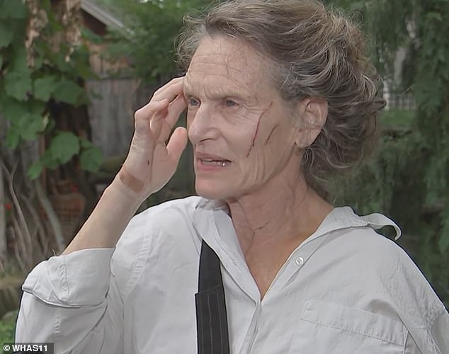 Katherine VanBuskirk, seen here, suffered injuries to her face, arms and legs after the attack on Saturday
