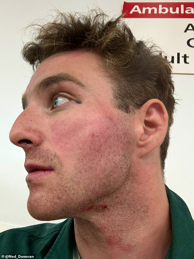 Volunteer police officer Ned Donovan was attacked after intervening to apprehend a pickpocket stealing from tourists last year
