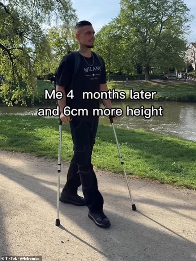 Now, in a series of videos posted to his social media channels, seen tens of millions of times, he has shown exactly what his recovery from the controversial surgeries entailed