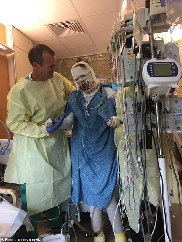 An American woman has revealed her miraculous recovery from a horror gas station explosion almost six years ago after the accident led to 40 per cent of her body being covered in third-degree burns