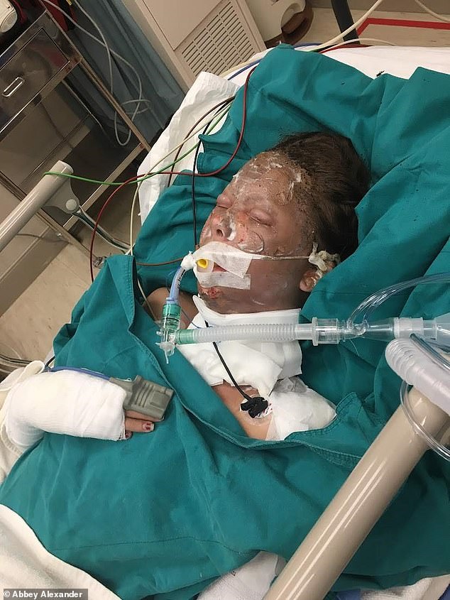 Abigail Alexander, from Colorado, US, was just 18 when she and a British friend were caught up in the blast while riding a motorcycle together in Siem Reap, Cambodia