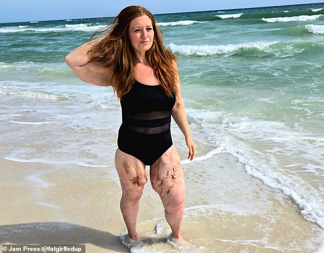 The US-based influencer is not embarrassed to show her loose skin in a swimsuit this summer