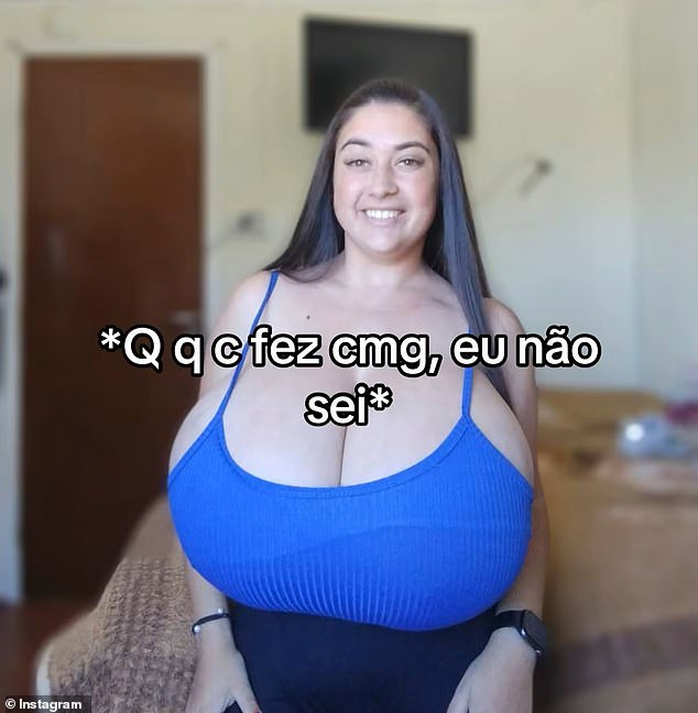 Thaynara Marcondes, 22 and from Brazil, suffers from gigantomastia - which is when the breasts grow rapidly and uncontrollably in size